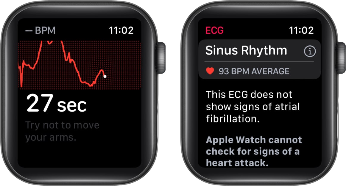 How to use ECG on Apple Watch  A complete guide - 98
