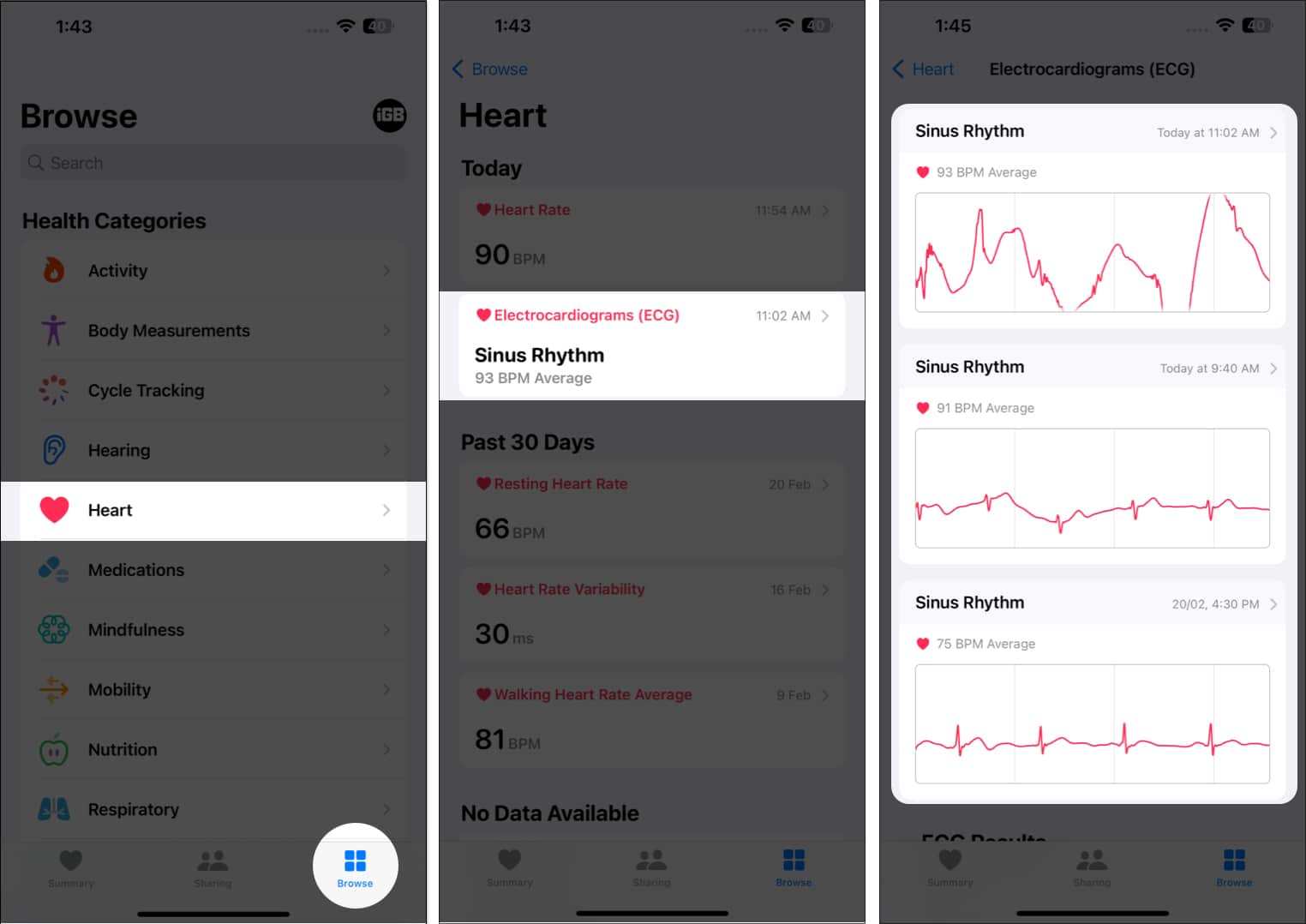 View ECG results on iPhone