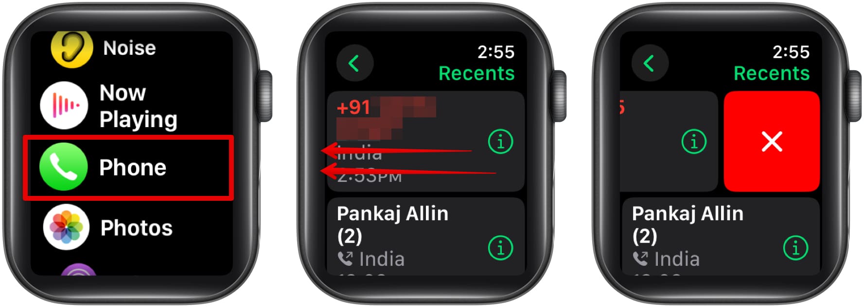 Egy nemrégiben történő hívás törlése a telefon alkalmazásban egy Apple Watch -on